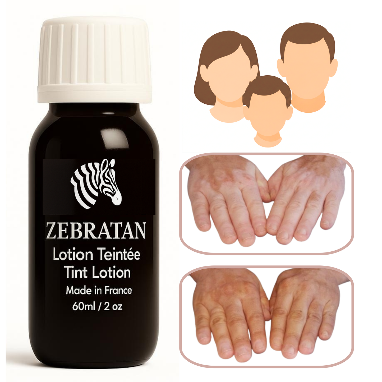 Zebratan Light Beige, vitiligo makeup lotion