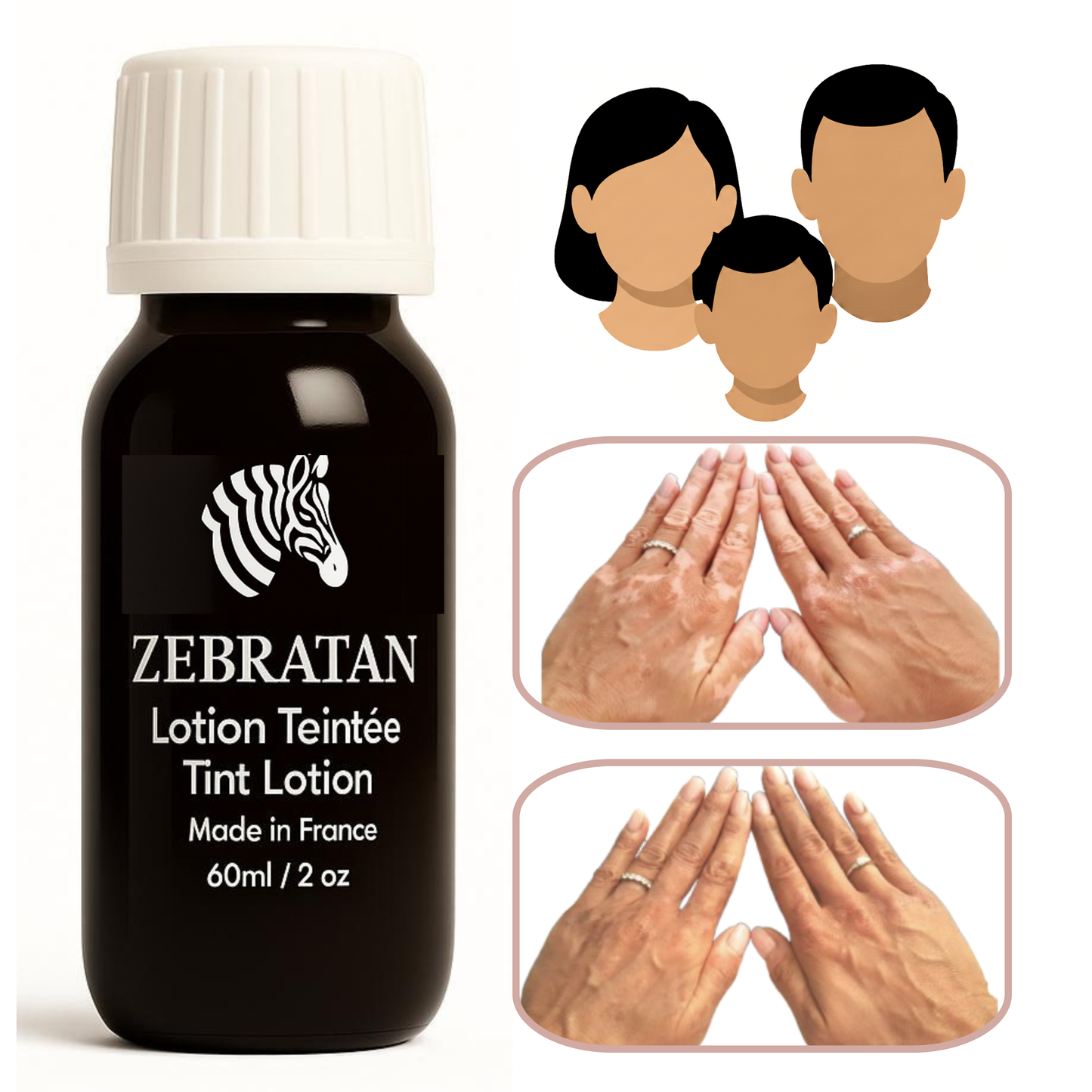 Zebratan Beige Brown, Vitiligo Makeup Lotion