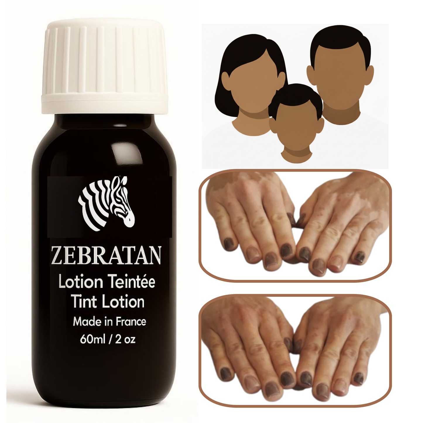 Zebratan Medium Brown, Vitiligo Makeup Lotion