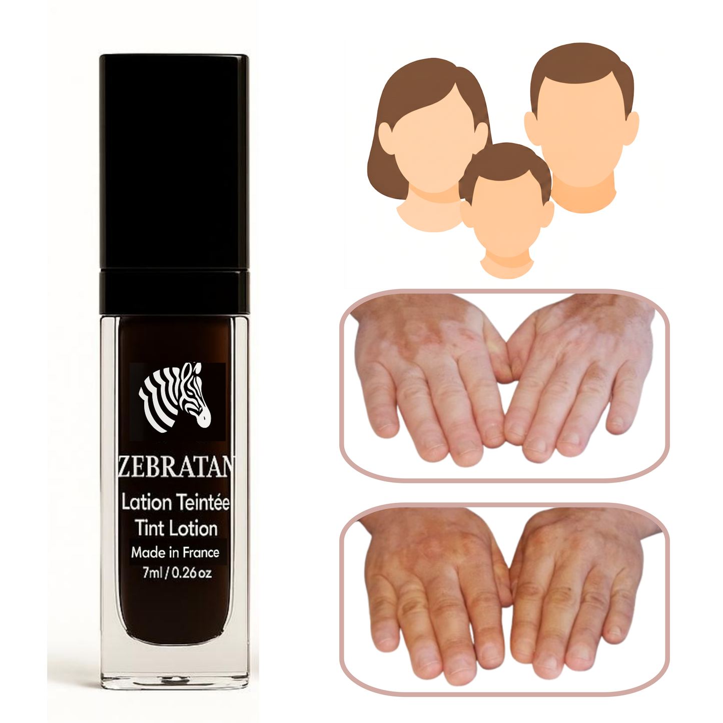 Zebratan Light Beige, vitiligo makeup lotion