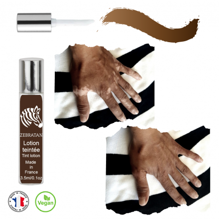 Camouflage vitiligo avant après