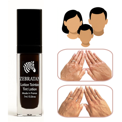 Zebratan Beige Brown, Vitiligo Makeup Lotion
