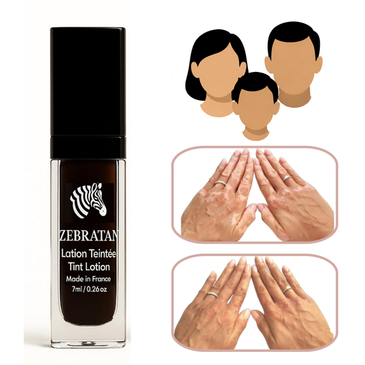 Zebratan Beige Brown, Vitiligo Makeup Lotion