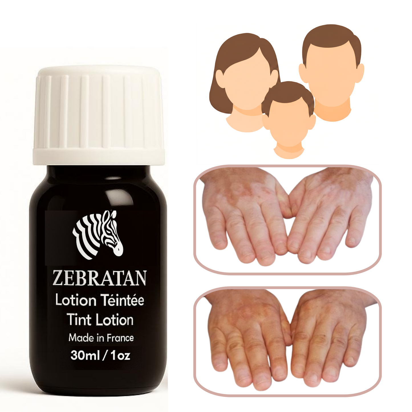 Zebratan Light Beige, vitiligo makeup lotion
