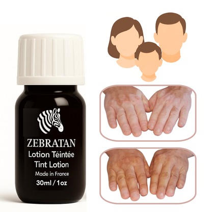 Zebratan Light Beige, vitiligo makeup lotion