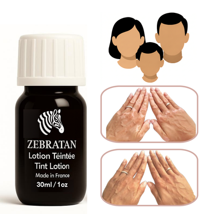 Zebratan Beige Brown, Vitiligo Makeup Lotion