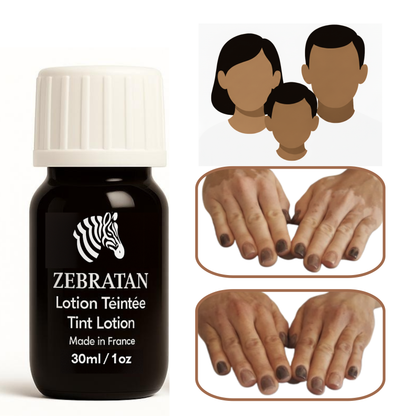 Zebratan Medium Brown, Vitiligo Makeup Lotion