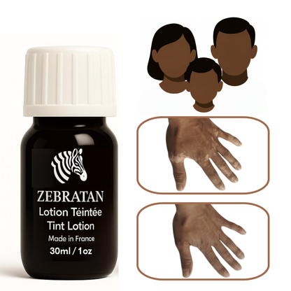 Zebratan Deep Brown, Vitiligo Makeup Lotion