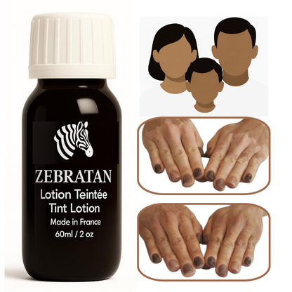 Zebratan Medium Brown, Vitiligo Makeup Lotion