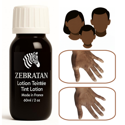 Zebratan Deep Brown, Vitiligo Makeup Lotion