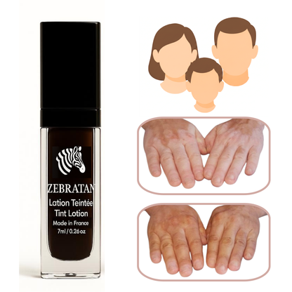 Zebratan Light Beige, vitiligo makeup lotion