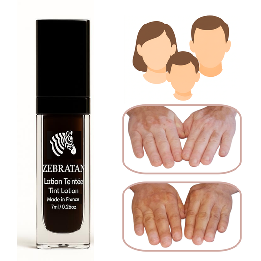 Zebratan Light Beige, vitiligo makeup lotion