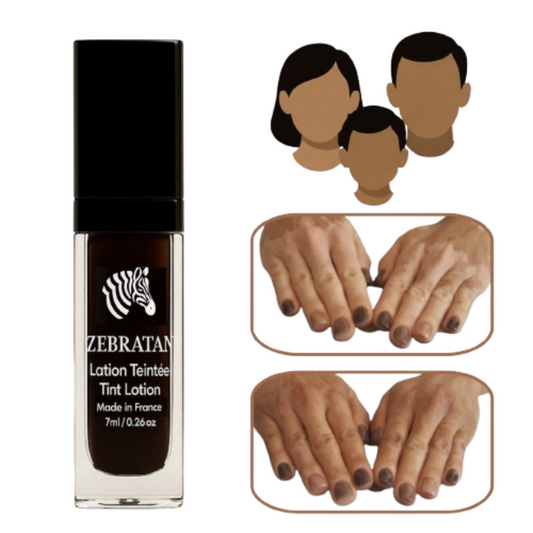 Zebratan Medium Brown, Vitiligo Makeup Lotion