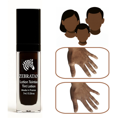 Zebratan Deep Brown, Vitiligo Makeup Lotion