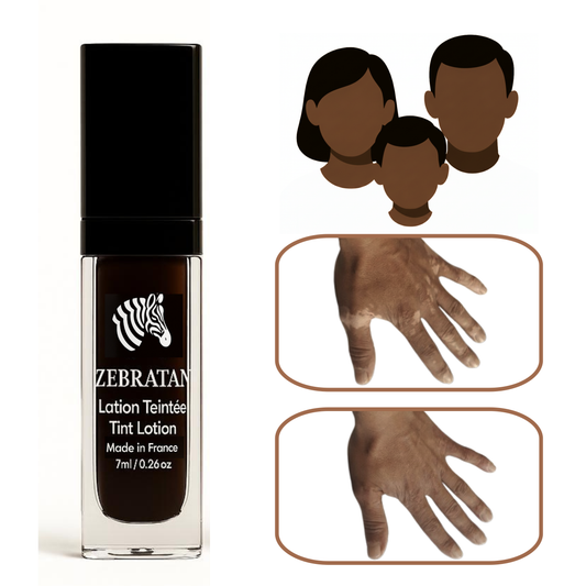 Zebratan Deep Brown, Vitiligo Makeup Lotion